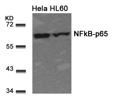 NFkB-p65(Ab-311) Antibody - Absci