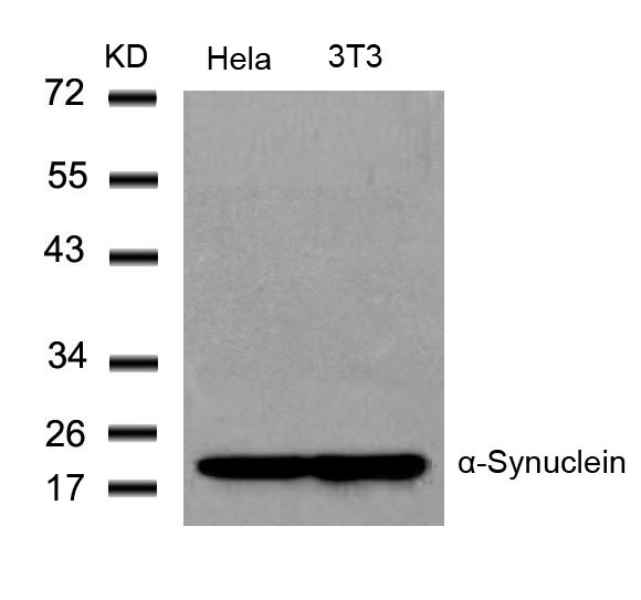 a-Synuclein(Ab-136) Antibody - Absci