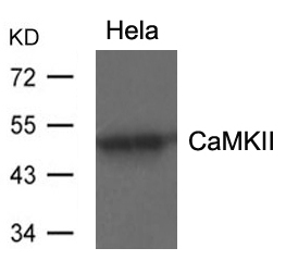 CaMKII(Ab-286) Antibody - Absci