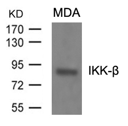 IKK-b(Ab-199) Antibody - Absci