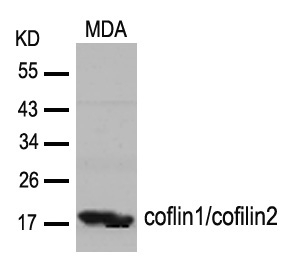 cofilin1/cofilin2(Ab-88) Antibody - Absci