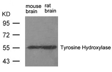 Tyrosine Hydroxylase(Ab-31) Antibody - Absci