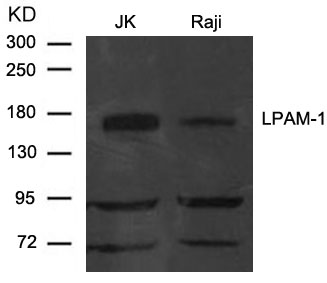LPAM-1(Integrin a4, CD49d) Antibody - Absci