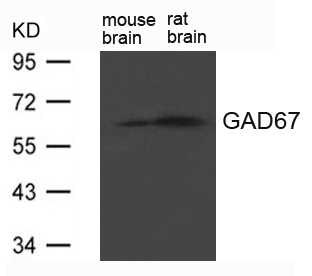 GAD67(GAD1) Antibody - Absci