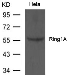Ring1A Antibody - Absci