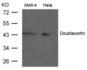 Doublecortin Antibody - Absci