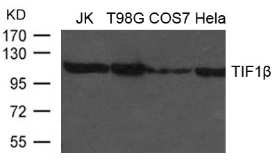 TIF1b Antibody - Absci