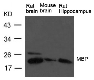 MBP(myelin basic protein) Antibody - Absci