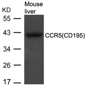 CCR5(CD195) Antibody - Absci