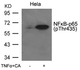 NFkB-p65(Phospho-Thr435) Antibody - Absci