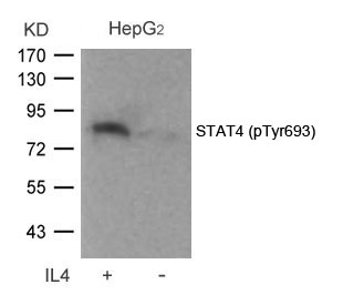 STAT4(Phospho-Tyr693) Antibody - Absci