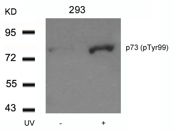p73(Phospho-Tyr99) Antibody - Absci