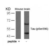 Tau(Phospho-Ser396) Antibody