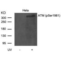 ATM(Phospho-Ser1981) Antibody