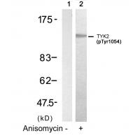 TYK2(Phospho-Tyr1054) Antibody