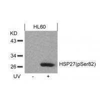 HSP27(Phospho-Ser82) Antibody