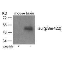 Tau(Phospho-Ser422) Antibody