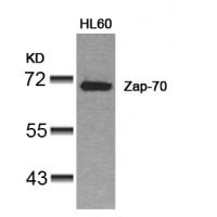 Zap-70(Ab-319) Antibody