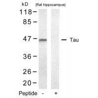 Tau(Ab-422) Antibody
