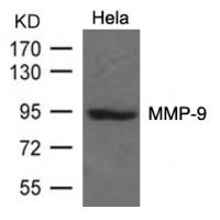 MMP-9 Antibody