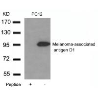 Melanoma-associated antigen D1 Antibody