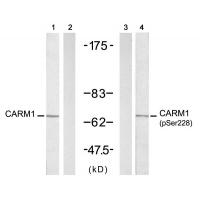 CARM1(Ab-228) Antibody