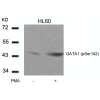 GATA1(Phospho-Ser142) Antibody