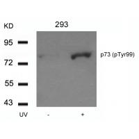 p73(Phospho-Tyr99) Antibody