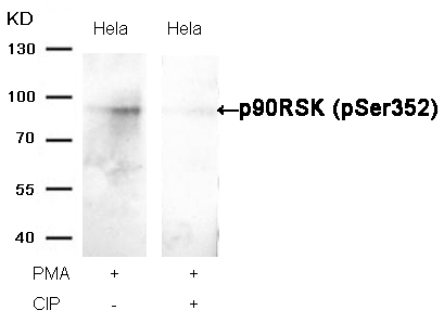 p90RSK(Phospho-Ser352) Antibody - Absci