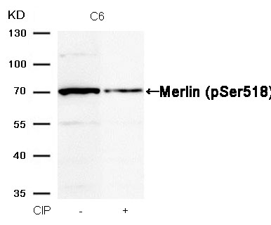 Merlin(Phospho-Ser518) Antibody - Absci