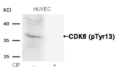 CDK6(phospho-Tyr13) Antibody - Absci