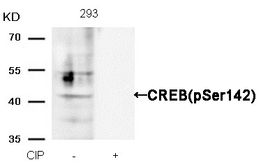 CREB(Phospho-Ser142) Antibody - Absci