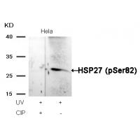HSP27(Phospho-Ser82) Antibody