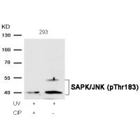 SAPK/JNK(Phospho-Thr183) Antibody