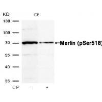 Merlin(Phospho-Ser518) Antibody