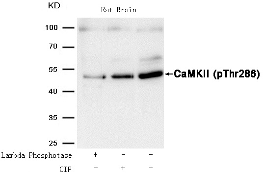 CaMKII(Phospho-Thr286) Antibody - Absci