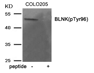 BLNK (Phospho-Tyr96) Antibody - Absci