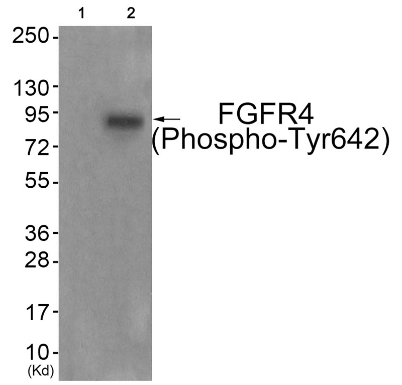 FGFR4 (Phospho-Tyr642) Antibody - Absci