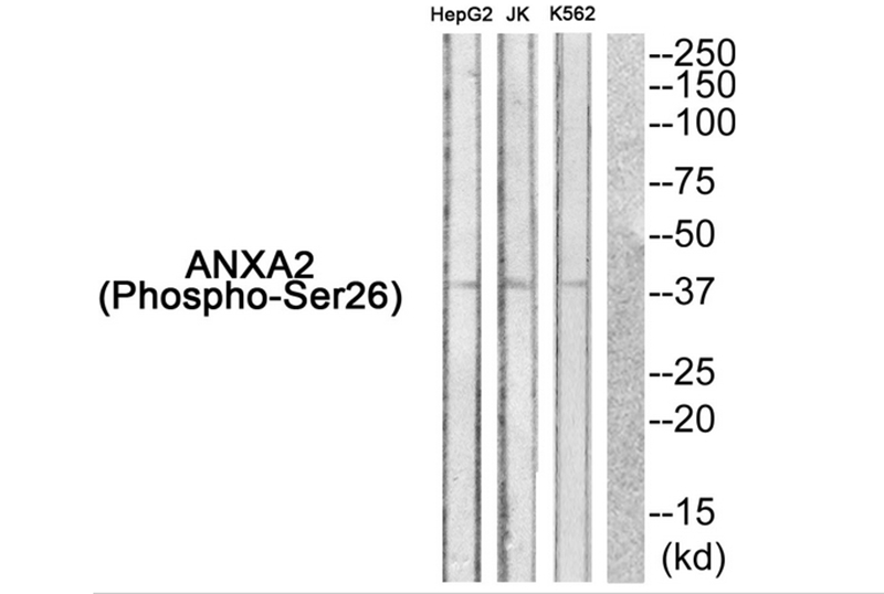 ANXA2 (Phospho-Ser26) Antibody - Absci