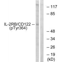 IL-2Rβ/CD122 (Phospho-Tyr364) Antibody