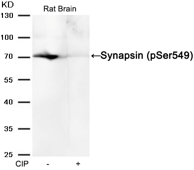 Synapsin(phospho-Ser549) Antibody - Absci