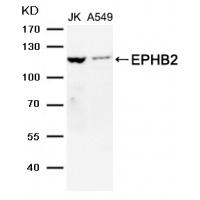 EPHB2 Antibody