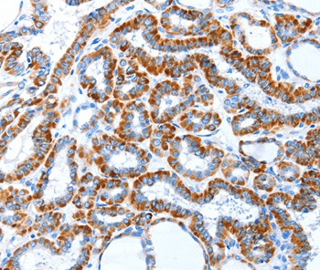 TLR2 Antibody - Absci
