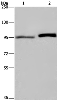 ELAC2 Antibody - Absci