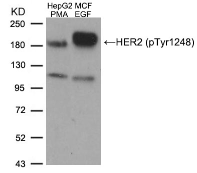 HER2(Phospho-Tyr1248) Antibody - Absci