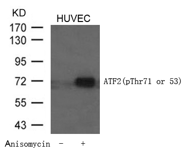 ATF2(Phospho-Thr71 or 53) Antibody - Absci