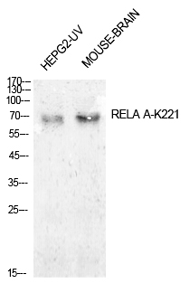 NFκB-p65 (Acetyl-Lys221) Polyclonal Antibody - Absci