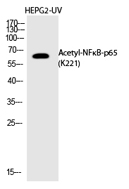 NFκB-p65 (Acetyl-Lys221) Polyclonal Antibody - Absci