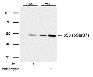 p53(Phospho-Ser37) Antibody - Absci