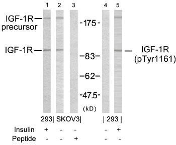 IGF-1R(Phospho-Tyr1161) Antibody - Absci